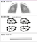 5Pcs Interior Ambient Light Kit for Benz GLE/GLS W167 2020-2025